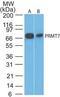 Protein Arginine Methyltransferase 7 antibody, PA1-41283, Invitrogen Antibodies, Western Blot image 