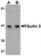 EGF Containing Fibulin Extracellular Matrix Protein 1 antibody, TA306794, Origene, Western Blot image 
