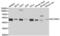 Histone-lysine N-methyltransferase SUV39H2 antibody, abx004492, Abbexa, Western Blot image 