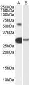 Transcription Factor Like 5 antibody, PA5-18588, Invitrogen Antibodies, Western Blot image 