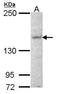 Jouberin antibody, TA308513, Origene, Western Blot image 