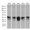 Uracil Phosphoribosyltransferase Homolog antibody, LS-C792235, Lifespan Biosciences, Western Blot image 