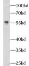 Nitric oxide synthase trafficker antibody, FNab05797, FineTest, Western Blot image 