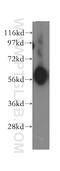 Lamin B Receptor antibody, 12398-1-AP, Proteintech Group, Western Blot image 