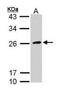 Glycoprotein Ib Platelet Subunit Beta antibody, orb89952, Biorbyt, Western Blot image 