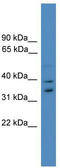 Ubiquitin Recognition Factor In ER Associated Degradation 1 antibody, TA342611, Origene, Western Blot image 