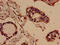 Ellis-van Creveld syndrome protein antibody, CSB-PA007862LA01HU, Cusabio, Immunohistochemistry frozen image 