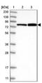 MAGE Family Member D2 antibody, NBP1-89412, Novus Biologicals, Western Blot image 