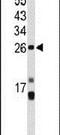 Centromere Protein H antibody, PA5-26221, Invitrogen Antibodies, Western Blot image 