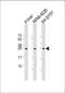 5',3'-Nucleotidase, Mitochondrial antibody, 61-197, ProSci, Western Blot image 