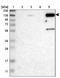Zinc Finger Protein 629 antibody, NBP1-93643, Novus Biologicals, Western Blot image 