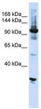Ribosomal RNA-processing protein 44 antibody, TA343820, Origene, Western Blot image 