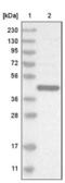 LAG1 longevity assurance homolog 3 antibody, NBP1-84535, Novus Biologicals, Western Blot image 