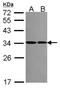 Ribosomal Protein S2 antibody, NBP2-20224, Novus Biologicals, Western Blot image 