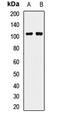 Piwi Like RNA-Mediated Gene Silencing 2 antibody, LS-C668786, Lifespan Biosciences, Western Blot image 