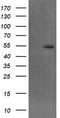 Makorin Ring Finger Protein 1 antibody, TA504092, Origene, Western Blot image 