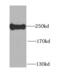Myosin Heavy Chain 9 antibody, FNab05479, FineTest, Western Blot image 