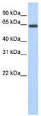 Regulator of nonsense transcripts 3B antibody, TA343972, Origene, Western Blot image 