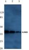 Aurora Kinase B antibody, A00762Y8, Boster Biological Technology, Western Blot image 