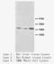 Decorin antibody, LS-C171989, Lifespan Biosciences, Western Blot image 