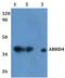 Abhydrolase Domain Containing 4 antibody, PA5-75867, Invitrogen Antibodies, Western Blot image 