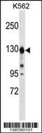 Extended Synaptotagmin 1 antibody, 58-756, ProSci, Western Blot image 