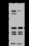 Nephrocystin-1 antibody, 203676-T44, Sino Biological, Western Blot image 