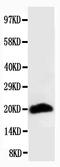 Myosin Heavy Chain 1 antibody, MA1063, Boster Biological Technology, Western Blot image 
