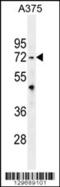 E3 ubiquitin-protein ligase TRIM56 antibody, 56-055, ProSci, Western Blot image 