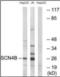 Sodium Voltage-Gated Channel Beta Subunit 4 antibody, orb375810, Biorbyt, Western Blot image 