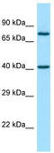 Matrix metalloproteinase-28 antibody, TA337989, Origene, Western Blot image 