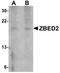 Zinc Finger BED-Type Containing 2 antibody, NBP1-77349, Novus Biologicals, Western Blot image 