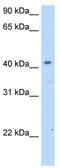 Solute Carrier Family 25 Member 24 antibody, TA333875, Origene, Western Blot image 
