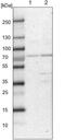 Chloride Voltage-Gated Channel 3 antibody, NBP1-91790, Novus Biologicals, Western Blot image 