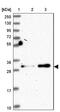 Galectin 9B antibody, NBP2-33473, Novus Biologicals, Western Blot image 