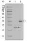 Lipoprotein(A) antibody, A00472, Boster Biological Technology, Western Blot image 