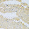 Pyrophosphatase (Inorganic) 1 antibody, 18-507, ProSci, Immunohistochemistry paraffin image 
