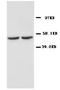 Potassium Calcium-Activated Channel Subfamily N Member 4 antibody, PA1047, Boster Biological Technology, Western Blot image 