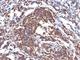 Vimentin antibody, V2927IHC-7ML, NSJ Bioreagents, Immunohistochemistry frozen image 