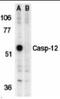Caspase-12 antibody, orb89026, Biorbyt, Western Blot image 