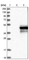 Protein Phosphatase, Mg2+/Mn2+ Dependent 1K antibody, PA5-54136, Invitrogen Antibodies, Western Blot image 