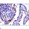 Jun Proto-Oncogene, AP-1 Transcription Factor Subunit antibody, LS-C813982, Lifespan Biosciences, Immunohistochemistry paraffin image 