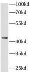 Complement Factor H Related 3 antibody, FNab01620, FineTest, Western Blot image 