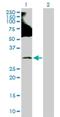E3 ubiquitin-protein ligase RNF138 antibody, H00051444-D01P, Novus Biologicals, Western Blot image 