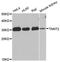 Troponin T2, Cardiac Type antibody, LS-C331280, Lifespan Biosciences, Western Blot image 