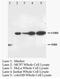 NICD antibody, AP23350PU-N, Origene, Western Blot image 
