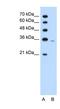 Phosphoribosyl Pyrophosphate Synthetase 2 antibody, NBP1-57670, Novus Biologicals, Western Blot image 