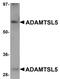 ADAMTS Like 5 antibody, PA5-20934, Invitrogen Antibodies, Western Blot image 
