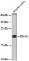 Dynein light chain 1, axonemal antibody, GTX65922, GeneTex, Western Blot image 