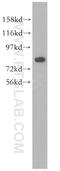 Homeobox protein cut-like 1 antibody, 11733-1-AP, Proteintech Group, Western Blot image 